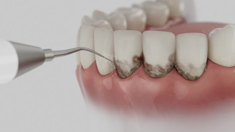 Reliable Emergency Dentist contractor in Marshall, TX by Smile Center Dentistry